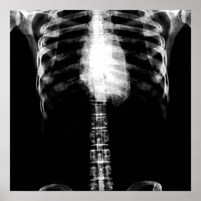 X-RAY SKELETON TORSO RIBS - B&W POSTER (Vorne)