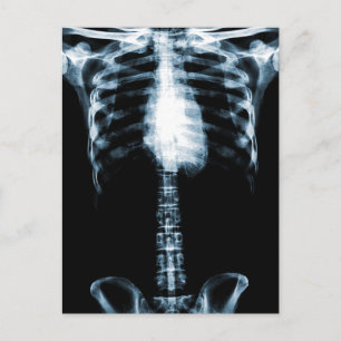 X-RAY SKELETON TORSO RIBS BLAUE POSTKARTE
