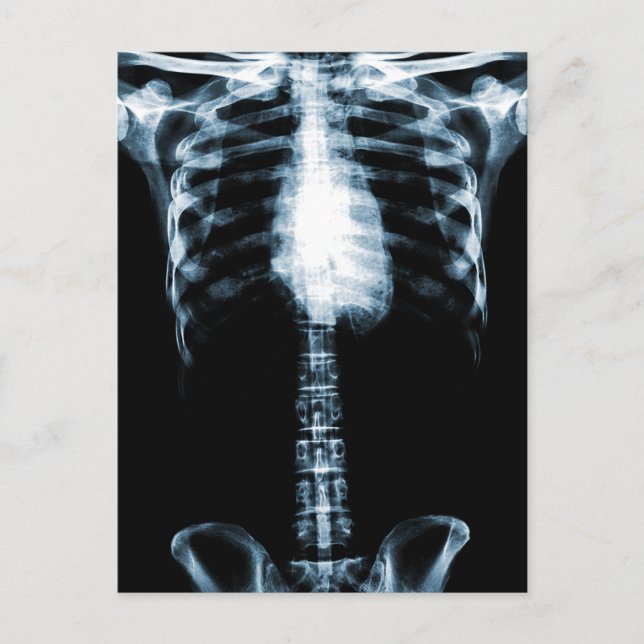X-RAY SKELETON TORSO RIBS BLAUE POSTKARTE (Vorderseite)