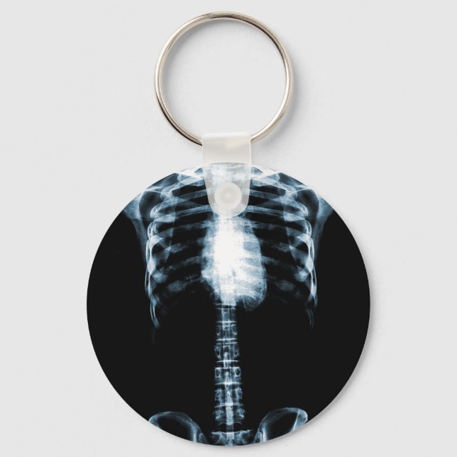 X-RAY SKELETON TORSO RIBS BLAUE SCHLÜSSELANHÄNGER (Vorderseite)