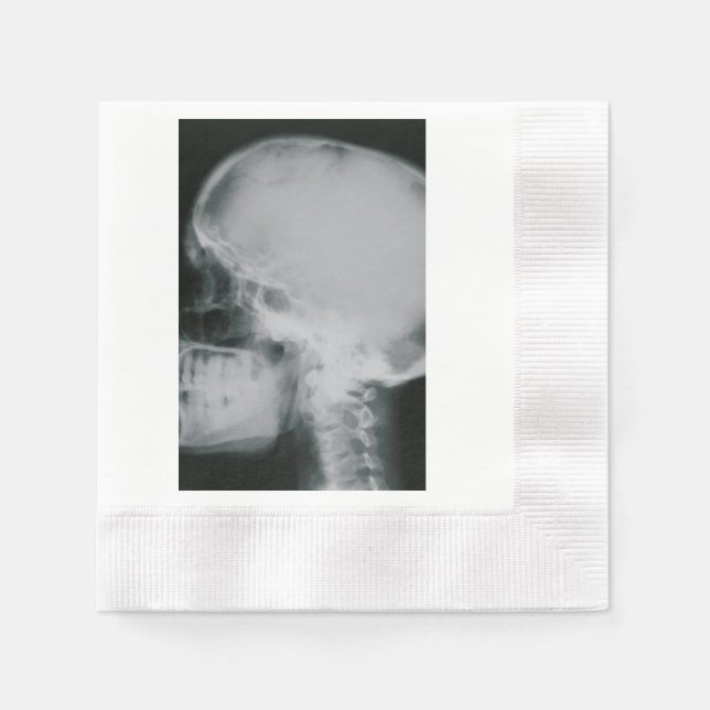 X-Ray Skull Serviette (Vorderseite)