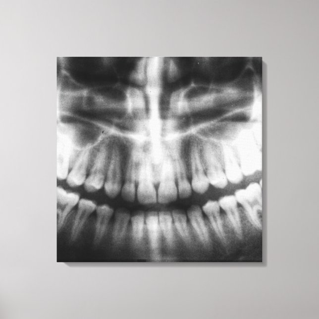 X-Ray Teeth Mouth Smile Schwarz-Weiß Leinwanddruck (Vorderseite)