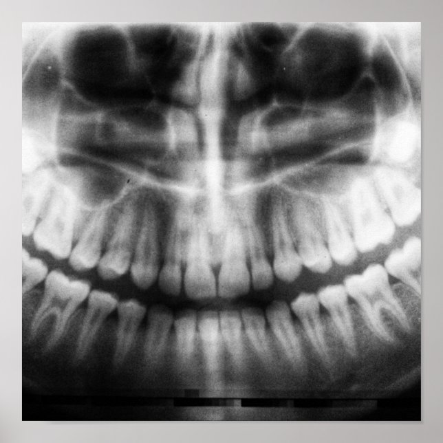 X-Ray Teeth Mouth Smile Schwarz-Weiß Poster (Vorne)