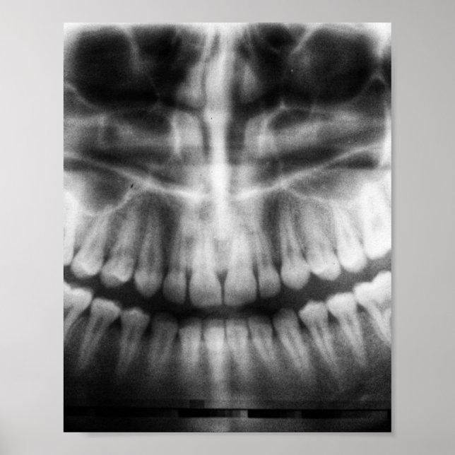 X-Ray Teeth Mouth Smile Schwarz-Weiß Poster (Vorne)