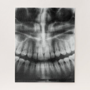X-Ray Teeth Mouth Smile Schwarz-Weiß Puzzle