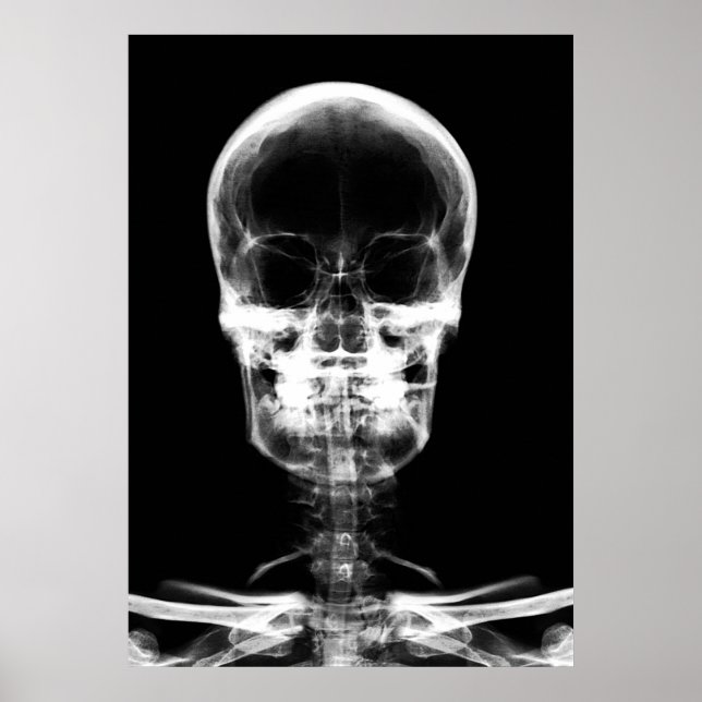X-RAY VISION SKELETON SKULL - B&W POSTER (Vorne)