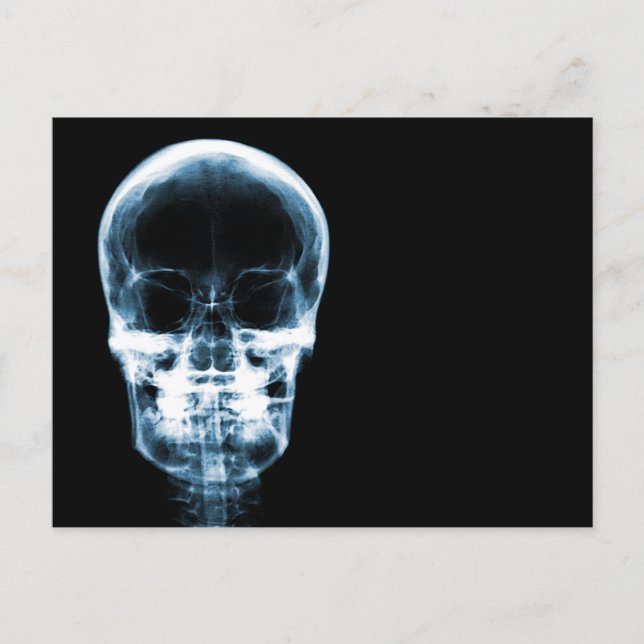X-RAY VISION SKELETON SKULL - BLAU POSTKARTE (Vorderseite)