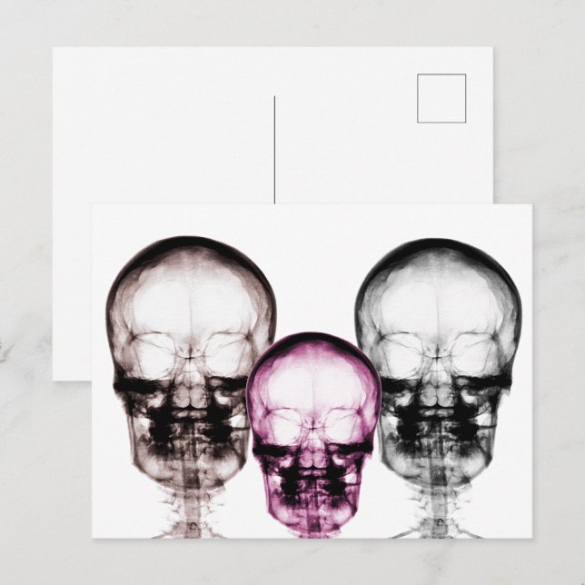 X-Ray-Vision-Skelettfächer in gemischten Farben Postkarte (Vorne/Hinten)