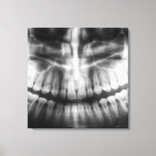 X-Ray Zähne Mouth Smile Schwarz und Weiß Leinwanddruck