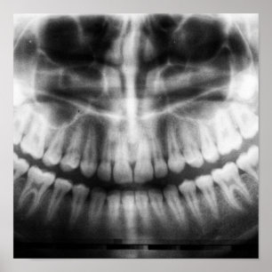 X-Ray Zähne Mouth Smile Schwarz und Weiß Poster