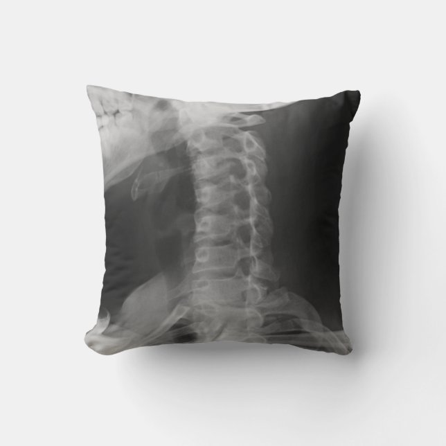 X-Rayed 2 (Original) Kissen (Vorderseite)