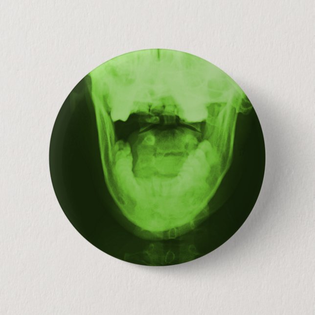 X-Rayed 3 - Radioaktiv Green Button (Vorderseite)