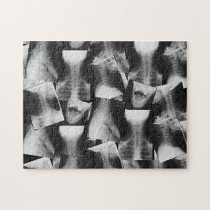 X-Rayed (Original) Puzzle