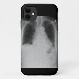 X Strahl ~ iPhone 5 CaseMatekasten Case-Mate iPhone Hülle