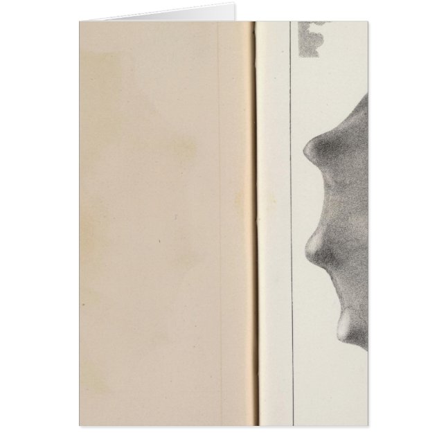 XIX Kreatinose (Vorne)