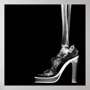 XRAY HIGH HEEL LADY SKELETON FOOT B&W POSTER