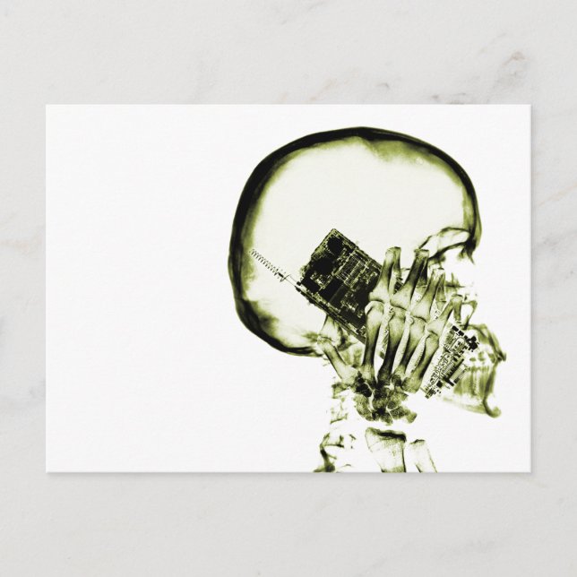 Yellow X-Ray Vision Skeleton Skull Postkarte (Vorderseite)