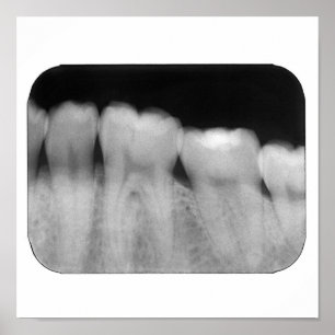 Zähne mit Füllung Poster