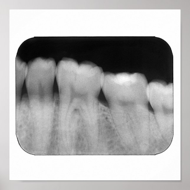 Zähne mit Füllung Poster (Vorne)