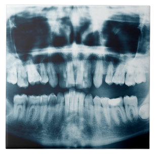 Zähne Röntgenaufnahme Fliese