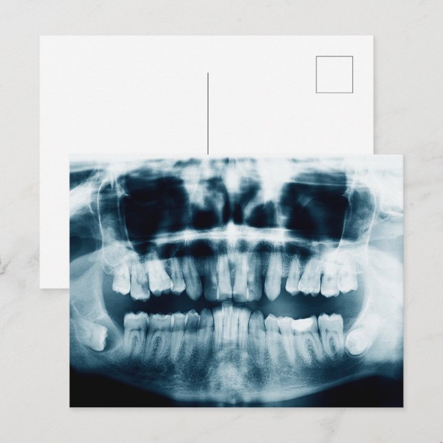 Zähne Röntgenaufnahme Postkarte (Vorne/Hinten)