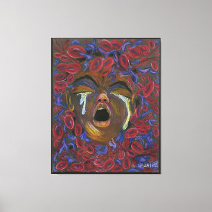 Zehn neu definiert - Sichelzellschmerzen Bewusstse Leinwanddruck