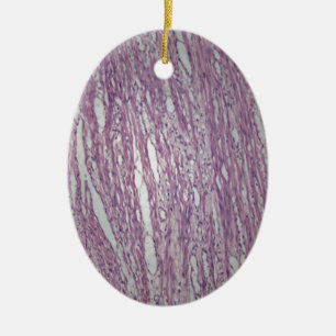 Zellen des menschlichen Gebärmuttergewebes mit Keramikornament