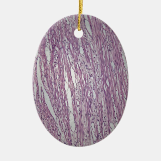 Zellen des menschlichen Gebärmuttergewebes mit Keramikornament (Vorne)