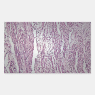 Zellen menschlichen Uterusgewebes mit unbeleidigen Rechteckiger Aufkleber