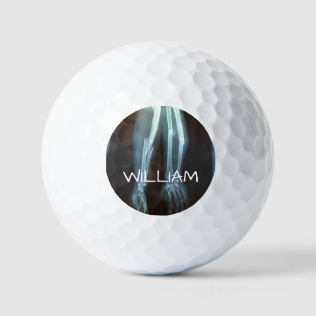 Zerbrochen Radius und Ulna Xray "Break Time" Golfball (Vorderseite)