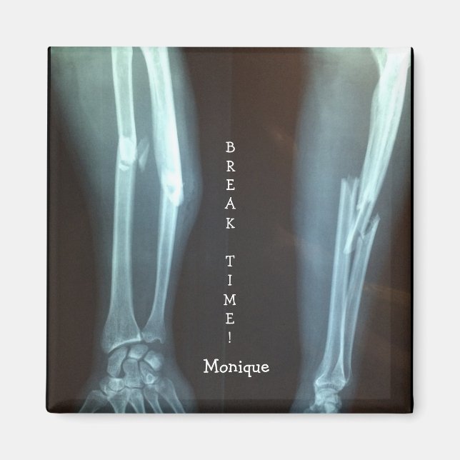 Zerbrochen Radius und Ulna Xray "Break Time" Magnet (Vorne)
