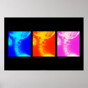 Zervikales Röntgenstrahl-Chiropraktikplakat 1 Poster