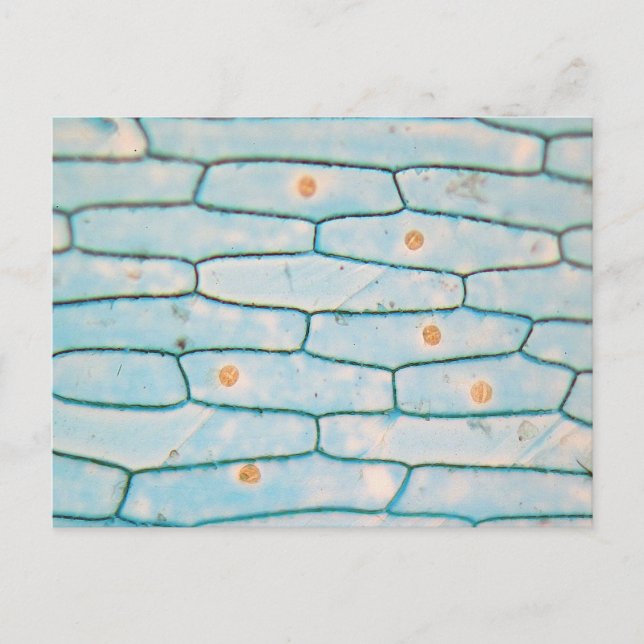 Zwiebel unter dem Mikroskop Postkarte (Vorderseite)